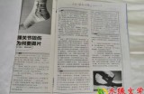 【水缘文学•卫生科普】踝关节扭伤为何要摄片||王金山(安徽)​​